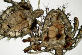 Rận mu tấn công bộ phận sinh dục