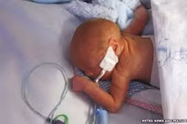 Sự sống 36 ngày