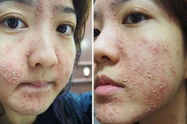 Đừng ham kem trắng da siêu tốc