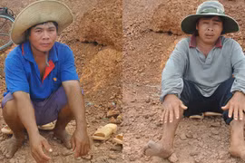 Kỳ lạ 2 anh em cùng "6 ngón", cùng sở thích giống nhau