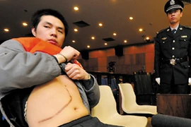 Lật tẩy đường dây nuôi nhốt người để… lấy nội tạng