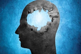 Chuyện lạ có thật về bộ não con người