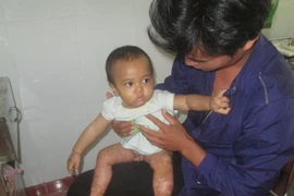 Cậu bé 1 tuổi bị bệnh lạ và những hủ tục đáng sợ