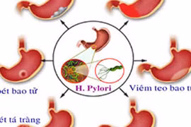Những tác nhân gây ung thư