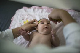 Phát hiện cháu bé đầu tiên tại Việt Nam nghi mắc chứng đầu nhỏ do virus Zika