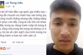 Lê Trung Hiếu tố bị cầu thủ SLNA đấm gãy sống mũi ở Cúp Quốc gia