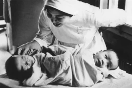 Phim tài liệu về cặp song sinh tách dính nổi tiếng chính thức ra rạp Việt Nam