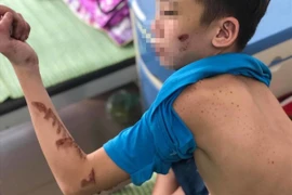 Từ nghi án chủ quán bánh xèo bạo hành nhân viên: Người nuôi con nhỏ dưới 36 tháng có bị xử lý hình sự?