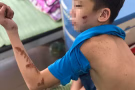 Từ nghi án chủ quán bánh xèo bạo hành nhân viên: Người nuôi con nhỏ dưới 36 tháng có bị xử lý hình sự?