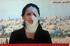 Dẫn chương trình với khuôn mặt băng bó