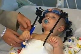 Tìm lại sự sống cho bé bị gãy rời đầu
