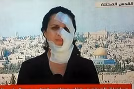 Dẫn chương trình với khuôn mặt băng bó