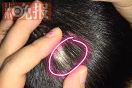 Bắt 4 giáo viên dùng kim đâm trẻ