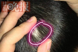 Bắt 4 giáo viên dùng kim đâm trẻ