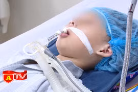 Cảnh báo trẻ bị biến chứng nặng do mắc viêm não Nhật Bản