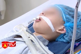 Cảnh báo trẻ bị biến chứng nặng do mắc viêm não Nhật Bản