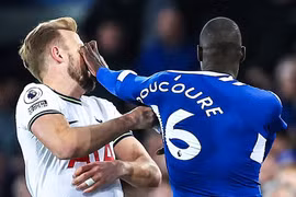 Cầu thủ Everton bị đuổi sau cú 'vả' vào mặt Harry Kane