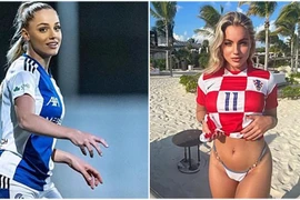 Nhan sắc nữ cầu thủ quyến rũ nhất thế giới vừa dính chấn thương nặng