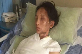 Phàn nàn chất lượng dịch vụ, khách hàng bị nhân viên trả thù bằng canh nóng