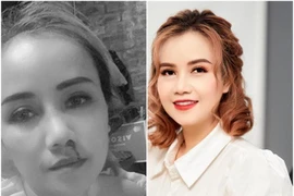 [ẢNH] Bi kịch bị chồng bạo hành của nhiều sao Việt