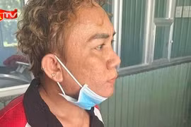 Bắt giữ ngay đối tượng điều khiển ô tô đâm thương vong thân nhân