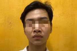 Lừa bán lan đột biến qua mạng xã hội, chiếm đoạt 118 triệu đồng