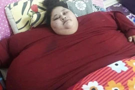 Cô gái nặng nhất thế giới chuẩn bị được phẫu thuật giảm béo tại Ấn Độ