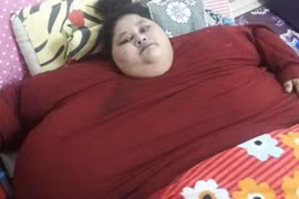 Cô gái nặng nhất thế giới chuẩn bị được phẫu thuật giảm béo tại Ấn Độ