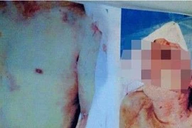 Trung Quốc: Phát hiện xác thanh niên có nghi vấn bị tra hỏi bức cung