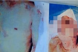 Trung Quốc: Phát hiện xác thanh niên có nghi vấn bị tra hỏi bức cung