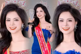 "Hoa hậu Nhân ái" Đào Thị Ngân chia sẻ về việc thực hiện dự án "Vòng tay yêu thương"