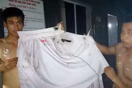 Xe chở dung dịch (nghi axít) bỏ chạy, bắn tung tóe gây bỏng nhiều người