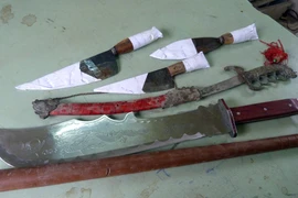 Bắt “nóng” nhóm đòi nợ thuê đánh gãy xương sườn “con nợ”