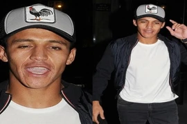 Tân binh trị giá 30 triệu bảng của Arsenal say mèm trên phố 