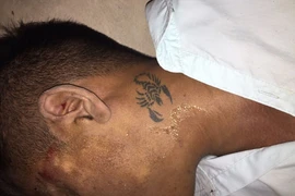 Tìm tung tích nạn nhân có hình xăm bọ cạp ở cổ