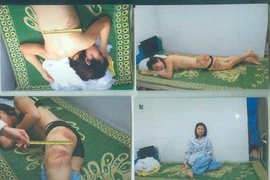 "Thòng lọng... ngọt ngào" trong vụ chồng đánh vợ tàn bạo