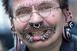 Người đàn ông nhiều "lỗ" nhất thế giới