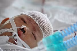 Bé 2 tuổi ở Trung Quốc vẫn trong cơn nguy kịch