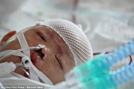 Bé 2 tuổi ở Trung Quốc vẫn trong cơn nguy kịch