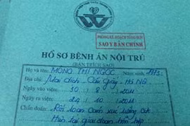 Vờ tâm thần… đi gây án 