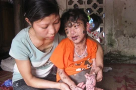 Rơi nước mắt vì cháu bé 9 tuổi bị hàng nghìn khối u quái ác hành hạ