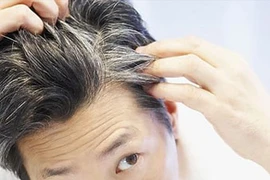 Hiện tượng tóc bạc sớm: Lý giải ở góc độ y khoa
