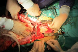 Quyết định hiến tạng sau khi chết não: Một người cứu sống 4 người 