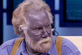 Người da xanh là có thật?