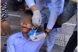 Vợ cựu chủ tịch phường ‘đứng sau’ vụ hành hung cán bộ tư pháp