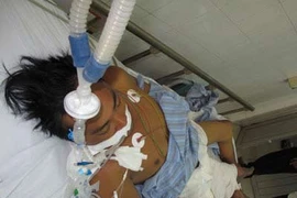 Hà Nội: Bệnh nhân đầu tiên tử vong do nhiễm liên cầu lợn