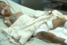 Bom bi phát nổ, 3 học sinh thương vong