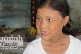 Khổ hạnh cô gái 25 tuổi rụng răng, nhăn nheo như bà lão