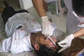 Côn đồ trút "mưa" dao xuống đầu phóng viên