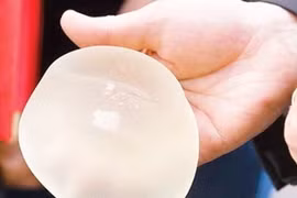 Ông chủ công ty sản xuất túi độn ngực PIP bị bỏ tù